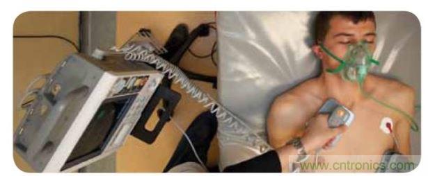 帶電極的醫(yī)院用除顫器。注意，患者身上有外部心電圖或心臟監(jiān)護(hù)儀，從胸部的白色圓片(電極)和導(dǎo)聯(lián)(線)可看出來。