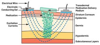  圖5.人體皮膚分層橫截面以及TMD和生物阻抗測量  考慮到生物阻抗分析的無創(chuàng)性，使用兩個金屬電極代表電氣傳感器，連接模擬前端(AFE)電路和患者皮膚。這個金屬與非金屬的接觸點(diǎn)是構(gòu)成整個電路的另一個關(guān)鍵部分，連接了AFE和人體電氣模型。電荷載體（電極中的電子和人體內(nèi)的離子）之間的相互作用可能對這些傳感器的性能產(chǎn)生重大影響，需要根據(jù)每種應(yīng)用進(jìn)行具體考慮。首先，金屬與離子溶液接觸的相互作用導(dǎo)致金屬表面附近溶液中離子濃度的局部變化。這種現(xiàn)象會改變電極下方區(qū)域的電荷中性，導(dǎo)致金屬周圍的電解質(zhì)電位與溶液其余部分不同，從而在金屬和電解質(zhì)主體之間產(chǎn)生一個電位差，即常說的“半電池電位”。其次，注入電流的直流分量會導(dǎo)致電極極化。  表1.各種電極類型和相應(yīng)的半電池電位  金屬及反應(yīng)  半電池電位(V)  Al → Al3+ + 3e- Al → Al3+ + 3e-  –1.706 –1.706  Ni → Ni2+ + 2e- Ni → Ni2+ + 2e-  –0.230 -0.230  H2 → 2H+ + 2e- H2 → 2H+ + 2e-  0.000 (by definition) 0.000（根據(jù)定義）  Ag + Cl- → AgCl + e- Ag + Cl- → AgCl + e-  +0.223 +0.223  Ag → Ag+ + e- Ag → Ag+ + e-  +0.799 +0.799  Au → Au+ + e- Au → Au+ + e-  +1.680 +1.680  這是一種不良現(xiàn)象，往往導(dǎo)致電極性能下降。這些考量表明，電極也需要定義適當(dāng)?shù)碾姎饽Ｐ停▍⒁妶D6）。我們可以將干電極表示為具有三個串聯(lián)元件的電路：一個用于模擬半電池電位(EHC)的直流電源；一個用于模擬金屬和非金屬（人體）之間接觸的RC并聯(lián)電池(Rd||Cd)；以及一個用于模擬電極金屬的電阻Rs。
